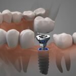 6fe150738dfd91c280d293bd612fa61a